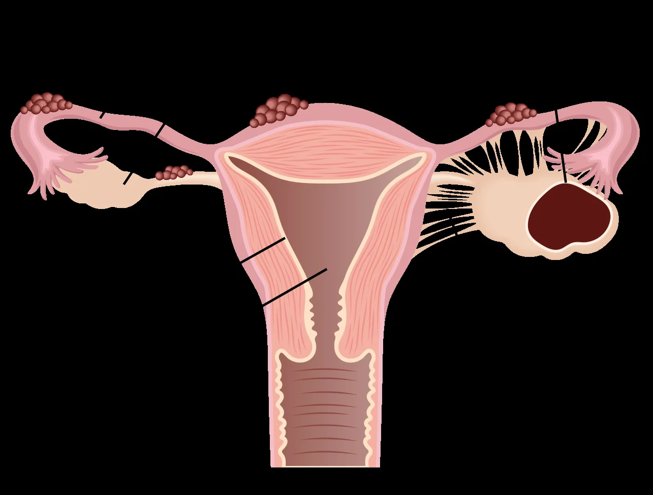 Coimbra Council Pushes Regional Autonomy to Cope with Storms